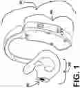 Fig. 02 - HEARING AID