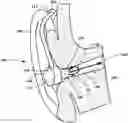 Fig. 01 - Apparatus and method for estimation of eardrum sound pressure based on secondary path measurement