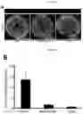 Fig. 02 - Method for integrating biological tissues with a vascular system