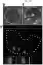 Fig. 04 - Method for integrating biological tissues with a vascular system