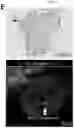 Fig. 11 - Method for integrating biological tissues with a vascular system