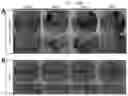 Fig. 12 - Method for integrating biological tissues with a vascular system