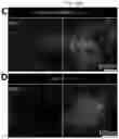 Fig. 13 - Method for integrating biological tissues with a vascular system