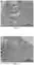 Fig. 06 - DMSO-FREE CRYOPRESERVATION SOLUTION AND PREPARATION METHOD AND USE THEREOF
