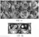 Fig. 02 - AFLATOXIN BIOCONTROL COMPOSITION