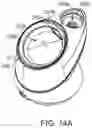 Fig. 15 - TRANSPORTABLE MOUTHPIECE