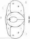 Fig. 36 - Fluid-based exoskeletal body armor with climate control