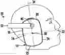 Fig. 01 - Earmuffs