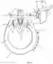 Fig. 14 - Magnetic track fasteners