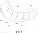 Fig. 05 - System and method for an eye patch used in eyelash extension procedure