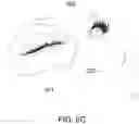 Fig. 09 - System and method for an eye patch used in eyelash extension procedure