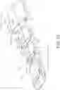 Fig. 17 - Article shield apparatus