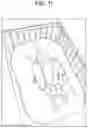 Fig. 12 - FUNCTIONAL OUTER COVER FOR FEEDING CUSHION AND FUNCTIONAL FEEDING CUSHION USING SAME
