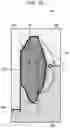 Fig. 14 - Method of molding elevator and endoscope