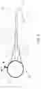 Fig. 04 - Method for fixation of a wire portion of an endoscope, and an endoscope