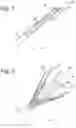 Fig. 02 - Steerable instrument comprising a detachable part