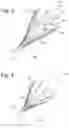 Fig. 03 - Steerable instrument comprising a detachable part