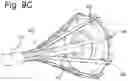 Fig. 08 - Steerable instrument comprising a detachable part