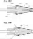 Fig. 10 - Steerable instrument comprising a detachable part