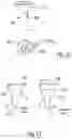 Fig. 07 - Scope