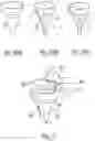 Fig. 11 - Scope
