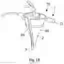 Fig. 12 - Scope