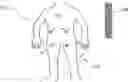 Fig. 01 - INTRA-BODY COMMUNICATION METHOD FOR IMPLANTED AND NON-IMPLANTED BIOSENSORS OR DEVICES