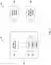 Fig. 02 - IMPLANTABLE PASSIVE MEAN PRESSURE SENSOR