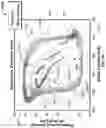 Fig. 17 - Cardiovascular assist system that quantifies heart function and facilitates heart recovery
