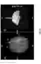 Fig. 06 - Trajectory alignment system and methods