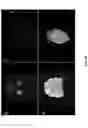 Fig. 07 - Trajectory alignment system and methods