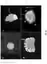 Fig. 10 - Trajectory alignment system and methods
