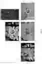 Fig. 23 - Trajectory alignment system and methods