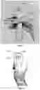 Fig. 12 - Ear imaging system