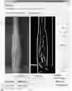 Fig. 01 - Systems and methods for autonomous intravenous needle insertion