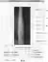 Fig. 26 - Systems and methods for autonomous intravenous needle insertion