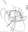 Fig. 05 - System and method for cardiac mapping