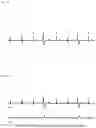 Fig. 06 - ELECTROCARDIOGRAM WAVEFORM ANALYSIS APPARATUS