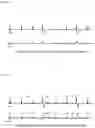 Fig. 07 - ELECTROCARDIOGRAM WAVEFORM ANALYSIS APPARATUS