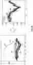 Fig. 08 - Method and system to detect P-waves in cardiac arrhythmic patterns