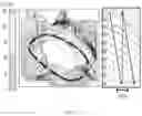 Fig. 07 - Ventricular arrhythmias and related methods