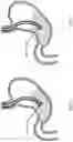 Fig. 04 - Devices and methods to measure gastric residual volume