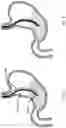 Fig. 05 - Devices and methods to measure gastric residual volume