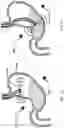 Fig. 07 - Devices and methods to measure gastric residual volume