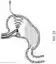 Fig. 08 - Devices and methods to measure gastric residual volume