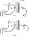 Fig. 11 - Devices and methods to measure gastric residual volume