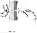 Fig. 12 - Devices and methods to measure gastric residual volume