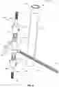 Fig. 10 - Invasive sense measurement in prosthesis installation and bone preparation