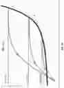 Fig. 13 - Invasive sense measurement in prosthesis installation and bone preparation