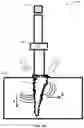Fig. 34 - Invasive sense measurement in prosthesis installation and bone preparation